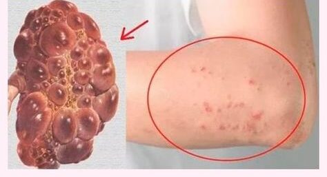 10 Signs Your Kidneys Are Not Working Properly